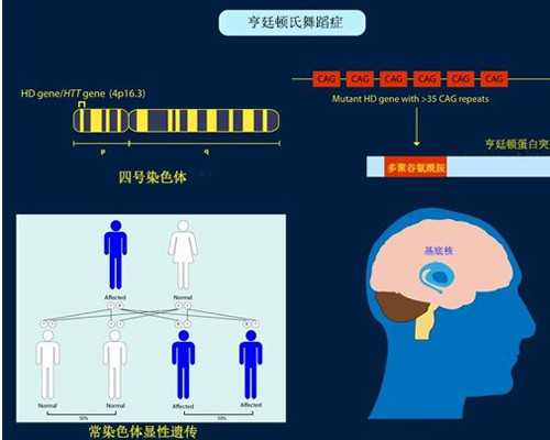 国内代生公司价格,做试管婴儿手术多少钱呢？父母家族有遗传病史能做试管婴儿吗 ...